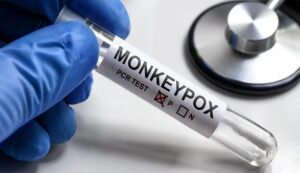 Monkeypox in kerala