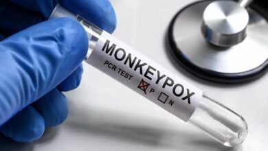 Monkeypox in kerala